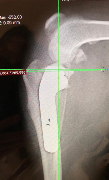 前十字靭帯断裂へのTPLO　術後X-ray