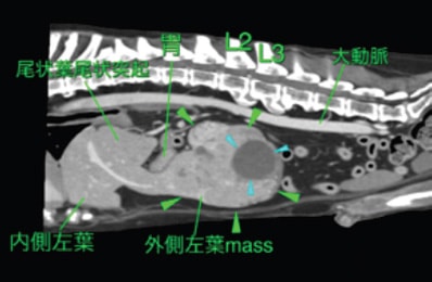 CT撮影時の腫瘍２