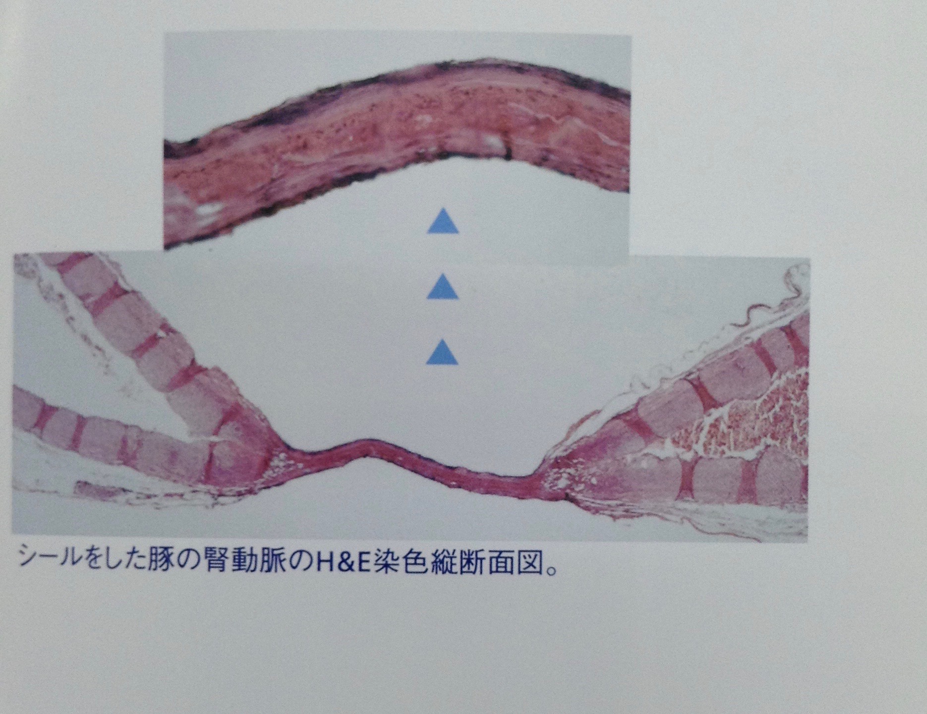 シールをした豚の腎動脈のH&E染色縦断面図